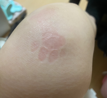 膝に肉球スタンプ